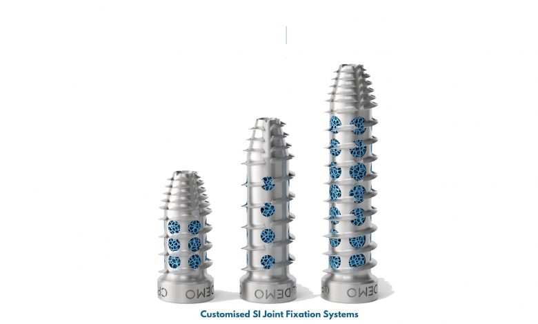 Croom Medical 推出 3D 打印的 SI 關(guān)節(jié)固定裝置